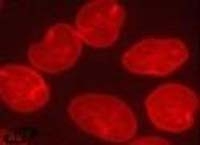 Fig. 6: Immunofluorescence staining of lamin A/C in HeLa cells using Cat.-No. SM5157