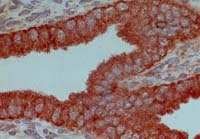 Fig. 2: Estrogen receptor alpha staining of rat samples (FFPE) with Cat.-No. DB 053