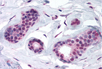 Fig. 3:  ESR2 antibody staining of human breast (FFPE) with Cat.-No. AP07156PU-N