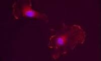 Fig. 5: Immunofluorescence with estrogen receptor beta/ESR2 antibody Cat.-No. SP5198P