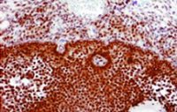 Fig. 6: Immunostained human ovary using monoclonal estrogen receptor beta antibody Cat.-No. SM1682