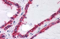 Fig. 2: Human thyroid (FFPE) stained with GRP78 antibody Cat.-No. AM20462SU-N
