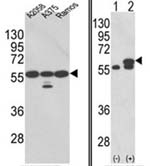 Fig. 5: Western blot analysis with GRP58 antibody Cat.-No. AP17626PU-N: LEFT: GRP58 (arrow) was detected using the purified antibody in A2058, A375, Ramos cell line lysates; RIGHT: GRP58 (arrow) was detected in 293 cell lysates either nontransfected (Lane 1) or transiently transfected with the PDIA3 gene (Lane 2)