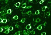 Fig. 7: Immunolocalization of calreticulin in rat brain cortex using calreticulin antibody Cat.-No. SP5414