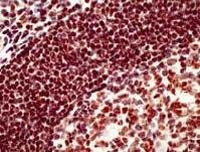 Fig. 1: Formalin-fixed, paraffin-embedded (FFPE) human tonsil stained with PARP1 antibody Cat.-No. AP15715PU-N