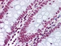 Fig. 2: Human colon (FFPE) stained with THOC1 antibody Cat.-No. AM06060PU-N