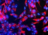 Fig. 5: Human SH-SY5Y cells stained with fibrillarin antibody Cat.-No. AM08249PU-N, showing prominent specular nucleolar staining (nuclei counter stained with DAPI DNA stain; very pale blue)