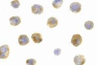 Fig.1: Immunocytochemistry staining of A431 cells using beclin-1 antibody Cat.-No. AP20057PU-N at 1 µg/ml Fig.1: Immunocytochemistry staining of A431 cells using beclin-1 antibody Cat.-No. AP20057PU-N at 1 µg/ml