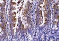 Fig. 2: Immunohistochemistry of PIST in rat colon tissue with PIST antibody Cat.-No. AP20060PU-N at 1 µg/ml Fig. 2: Immunohistochemistry of PIST in rat colon tissue with PIST antibody Cat.-No. AP20060PU-N at 1 µg/ml