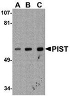 Fig. 3: Western blot analysis of PIST in PC-3 cell lysate with PIST antibody Cat.-No. AP20061PU-N at (A) 1, (B) 2 and (C) 4 µg/ml Fig. 3: Western blot analysis of PIST in PC-3 cell lysate with PIST antibody Cat.-No. AP20061PU-N at (A) 1, (B) 2 and (C) 4 µg/ml