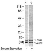 Fig. 4: Western blot analysis of extract from human HeLa cells using LC3A antibody Cat.-No. AP08079PU-N Fig. 4: Western blot analysis of extract from human HeLa cells using LC3A antibody Cat.-No. AP08079PU-N