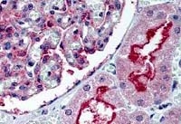 Fig. 5: Formalin-fixed, paraffin-embedded kidney tissue stained with ATG7 antibody Cat.-No. AP08525PU-N Fig. 5: Formalin-fixed, paraffin-embedded kidney tissue stained with ATG7 antibody Cat.-No. AP08525PU-N