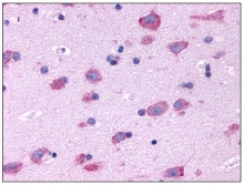 SP4047P - Serotonin receptor 2B (HTR2B)