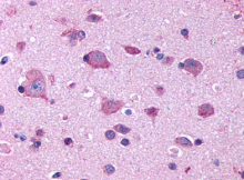 SP4046P - Serotonin receptor 2B (HTR2B)