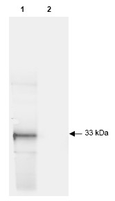 R1091P - GFP