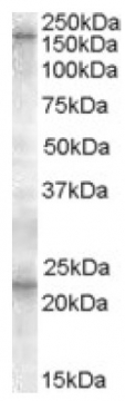 AP17054PU-N - ABCC8