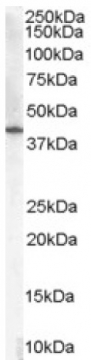 AP16478PU-N - 3-beta-HSD1 / HSD3B1