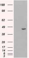 AP16478PU-N - 3-beta-HSD1 / HSD3B1
