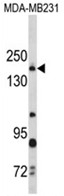 AP18219PU-N - Thrombospondin-1 (THBS1)