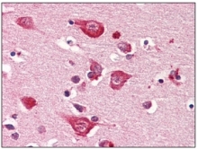AM09044PU-N - 14-3-3 protein gamma