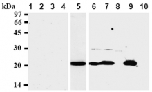 AM00283AF-N - Bax