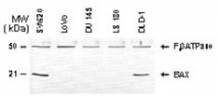 AP21607SU-S - Bax