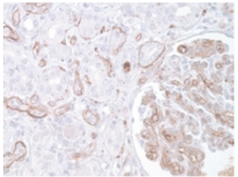 AP10423PU-N - Complement C3d