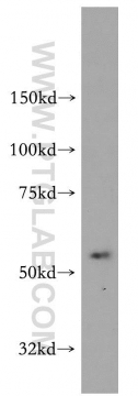 14021-1-AP - NCEH1 / AADACL1