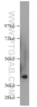 14192-1-AP - 11-beta HSD2 / HSD11B2