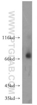 17874-1-AP - MMP-8