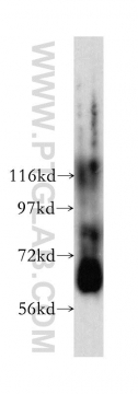 51008-2-AP - ABCE1