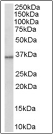 AP16309PU-N - 11-beta HSD1 / HSD11B1