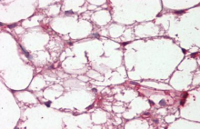 AP21459SU-N - Complement C3c