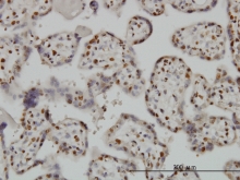 H00000581-M01 - Bax