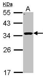 NBP1-32027 - 11-beta HSD1 / HSD11B1