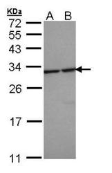 NBP1-32695 - 14-3-3 protein epsilon