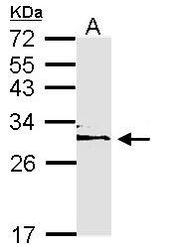 NBP1-33554 - 14-3-3 protein epsilon