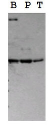 19510002 - Serotonin receptor 2B (HTR2B)