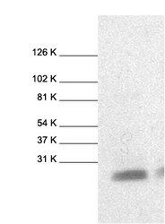 NB120-7977 - Bax