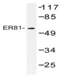 NBP1-19679 - ETV1 / ER81