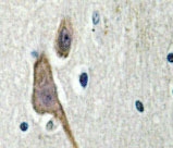 NBP1-19623 - 14-3-3 protein zeta/delta