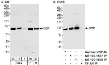 NB100-1557 - TER ATPase / VCP