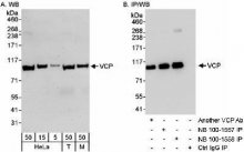 NB100-1558 - TER ATPase / VCP