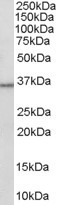 NB300-934 - 11-beta HSD1 / HSD11B1