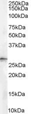 NB100-2465 - 14-3-3 protein sigma / SFN