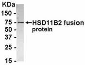 NB100-75626 - 11-beta HSD2 / HSD11B2