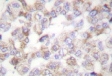NB100-91646 - 14-3-3 protein zeta/delta