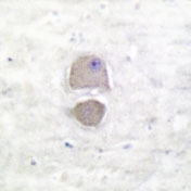 NB100-91674 - Bax