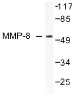 NB100-91880 - MMP-8