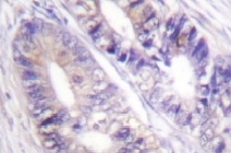 NB100-92268 - 14-3-3 protein zeta/delta